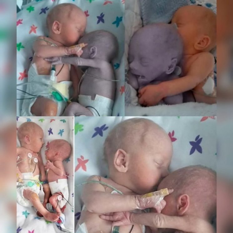 ČUDO DODIRA I ZAGRLJAJA